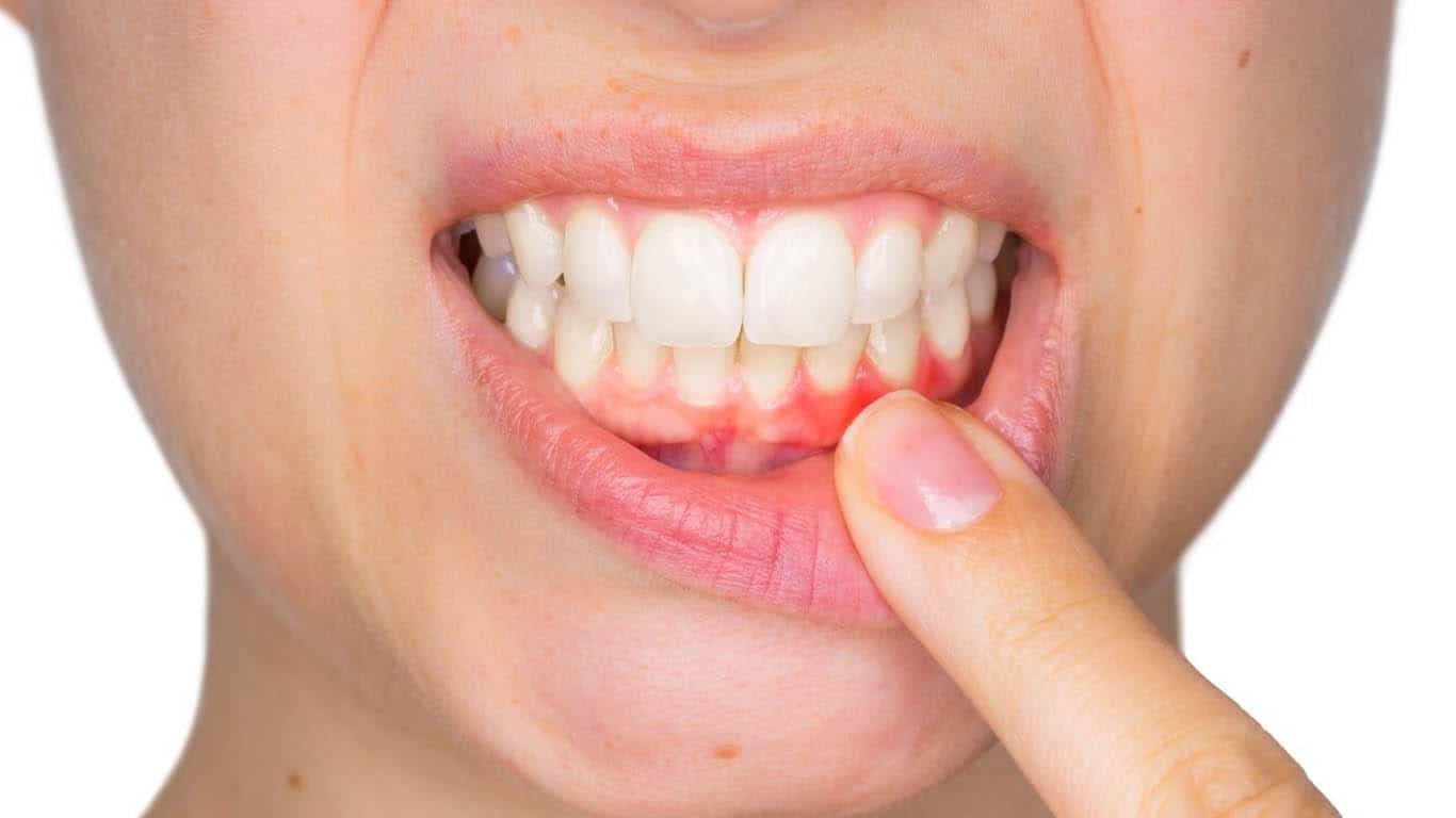 bad-breath-gum-disease-dent-care-dental-clinic